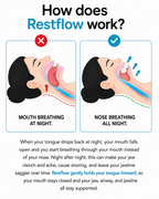 Restflow Tongue Positioning Retainer