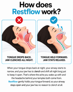 Restflow Tongue Positioning Retainer
