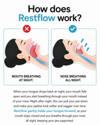 Restflow Tongue Positioning Retainer