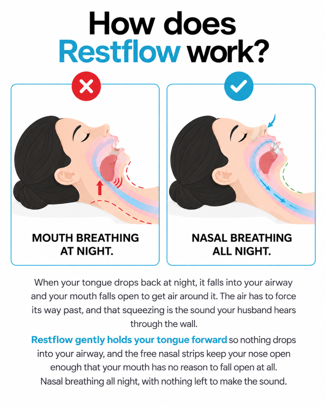 Restflow Tongue Positioning Retainer